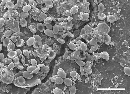 Pathogenic fungi colonise microplastics in soils