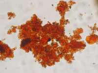Microscope pictures of iron oxide aggregates: brigthfield mode