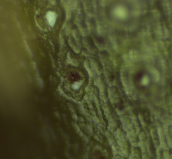 Dark fungus living in a stoma of Picea abies