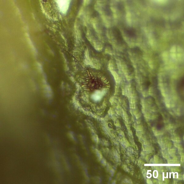 Melanized fungus in a stoma of Picea abies.